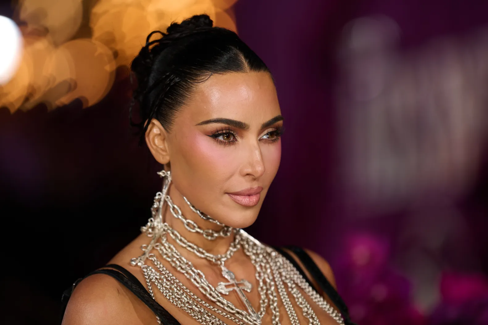 kim kardashian brain aneurysm